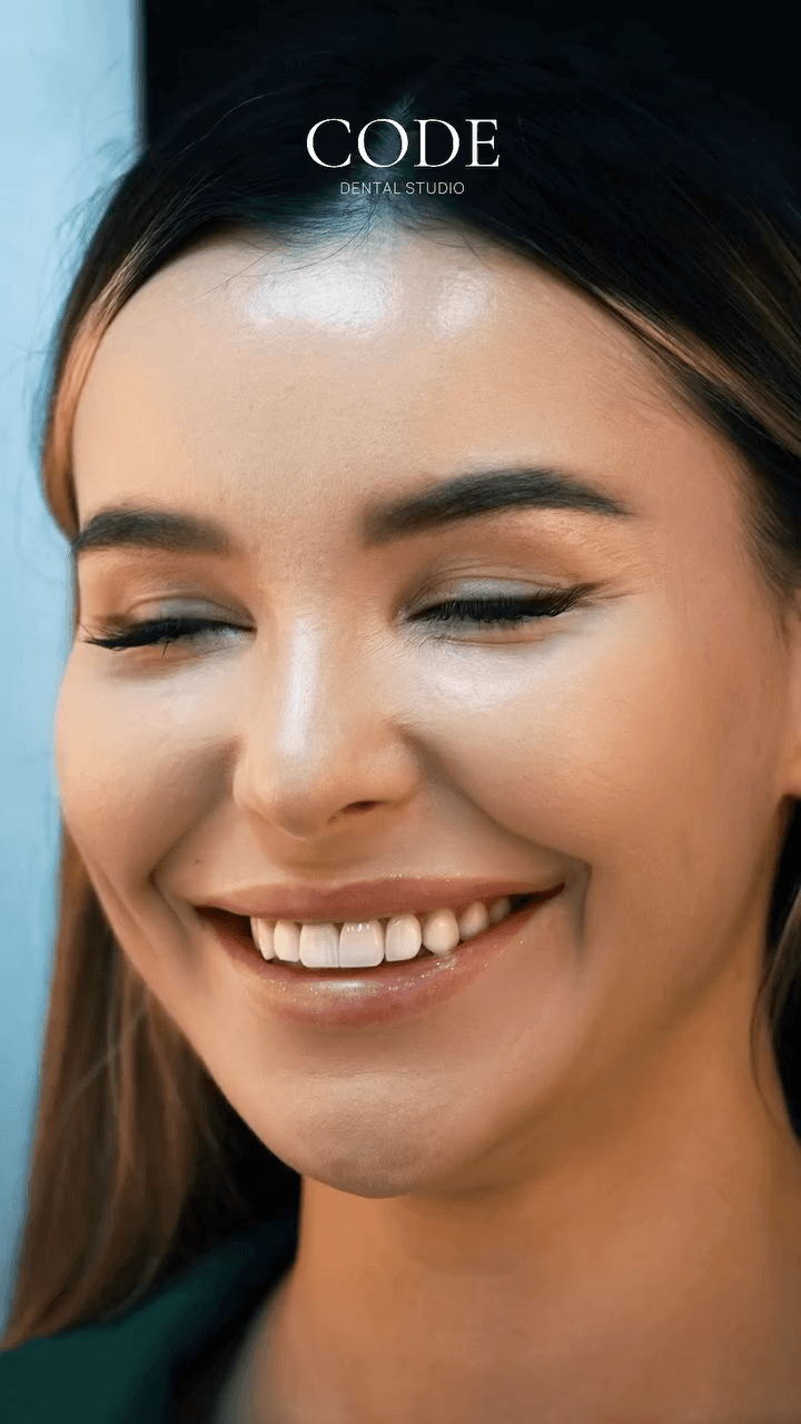 Улыбка пациентки Code Dental крупным планом